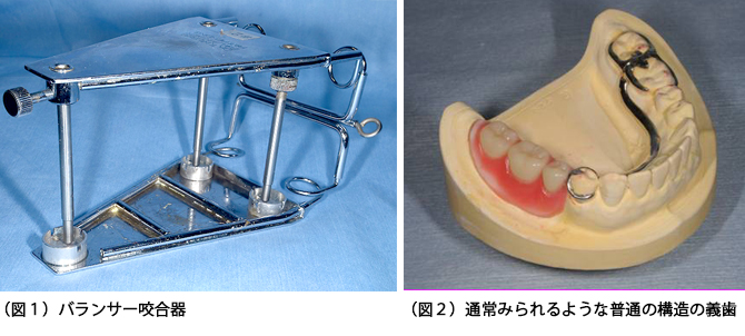 バランサー咬合器